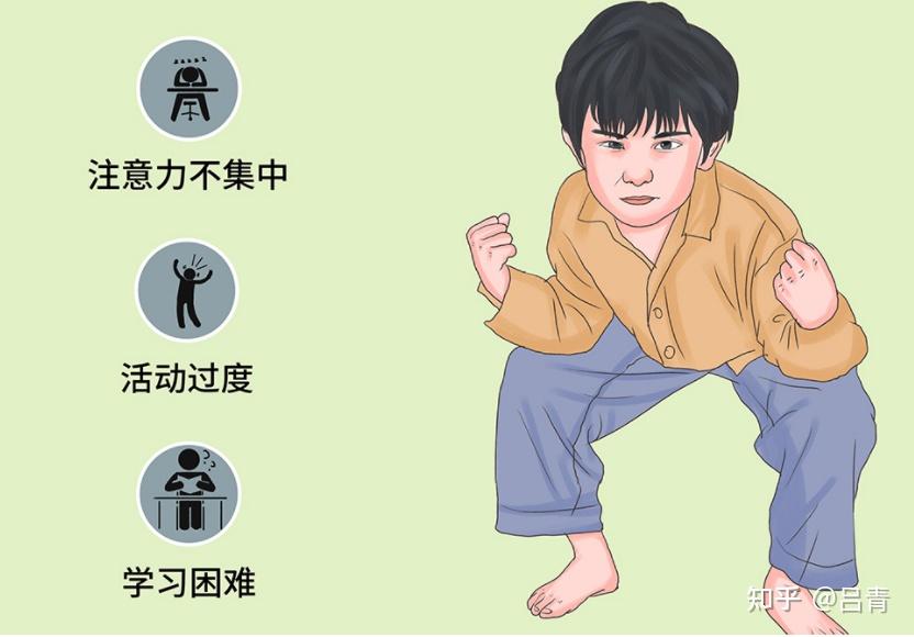 多动症产生的原因有哪些呢? - 知乎