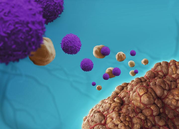 What Does Tumor Infiltrating Lymphocytes Present Non Brisk Mean