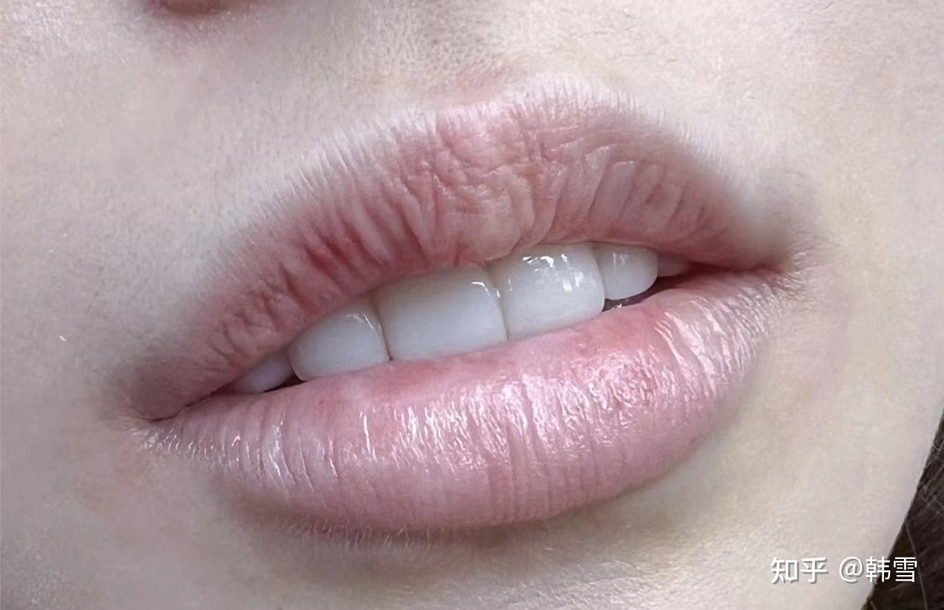 嘴唇变乌? - 知乎