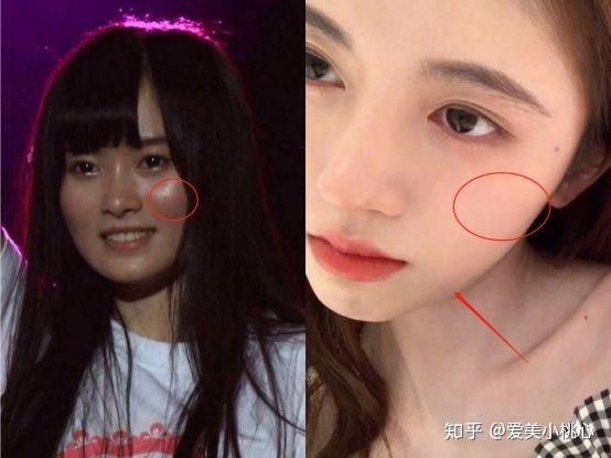 鞠婧祎到底整容了没有?