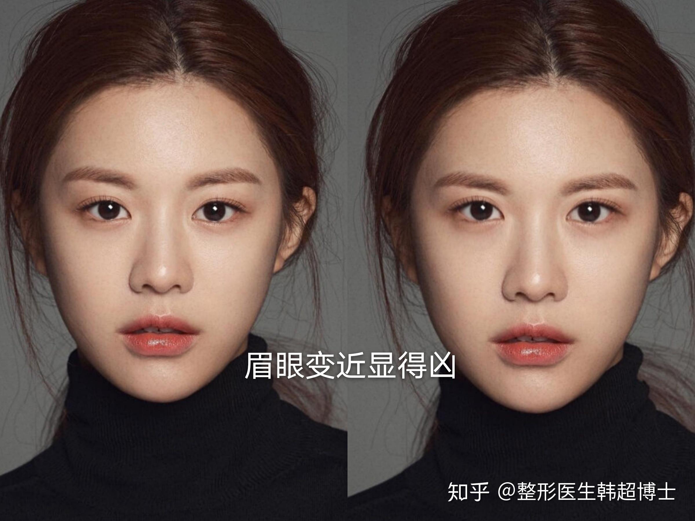 眉眼距宽会给人什么感觉? - 知乎