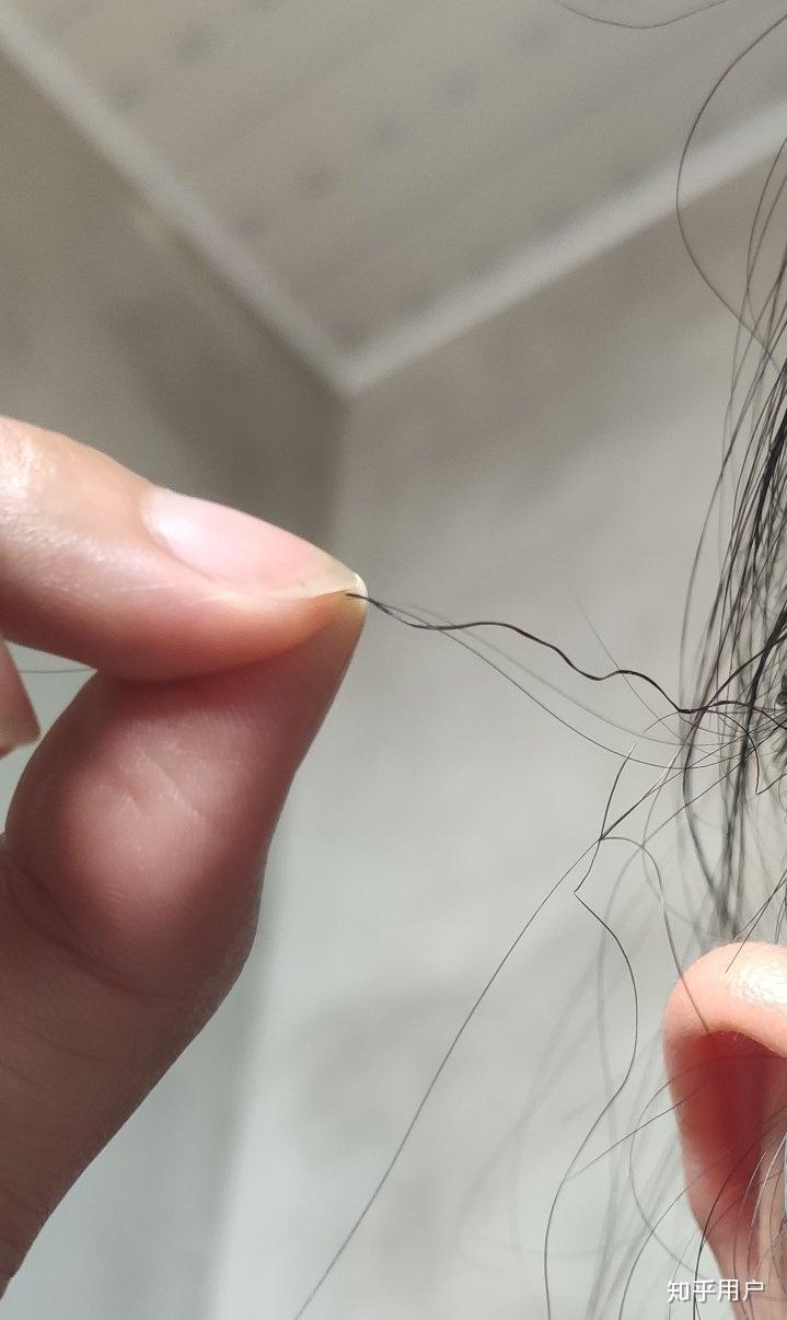 为什么头发中有几根头发长得很粗弯弯曲曲的有的头发却细软发黄