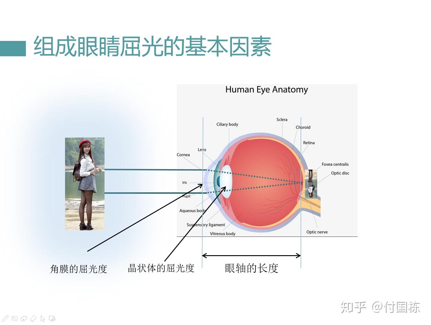 蔡司成长乐和阿波罗新瞳学哪个好一些? - 知乎