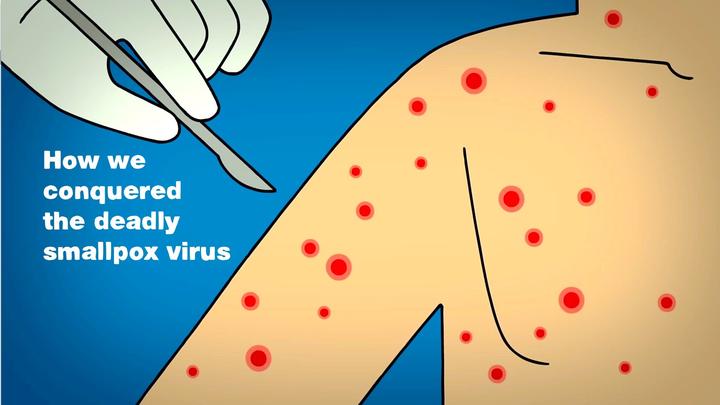 我们如何征服致命的天花病毒