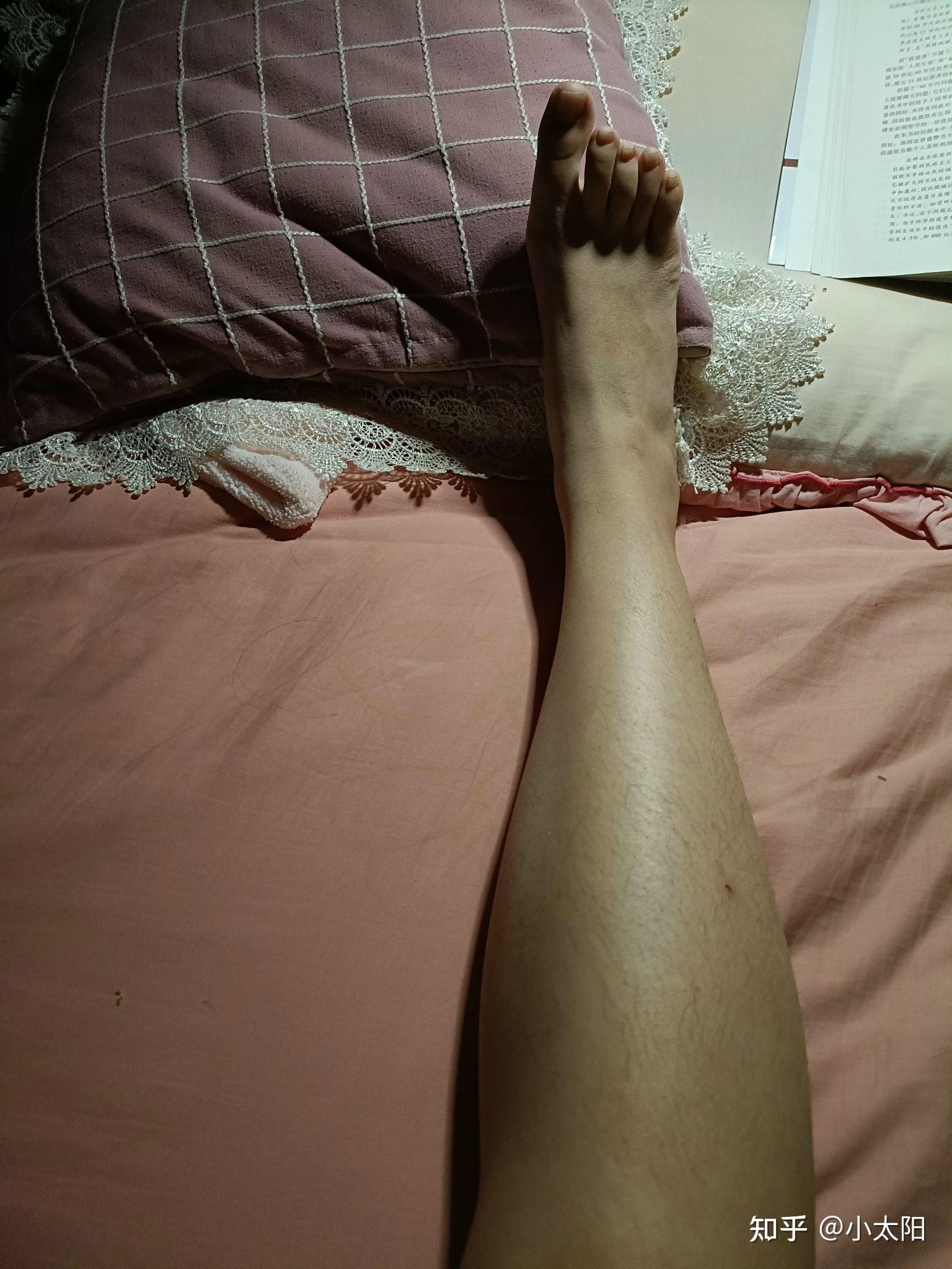 大脚趾特别长,比其他脚趾长很多的人,在现实中存在吗? - 知乎