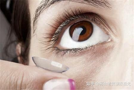 一副隐形眼睛多少钱，一副隐形牙套多少钱