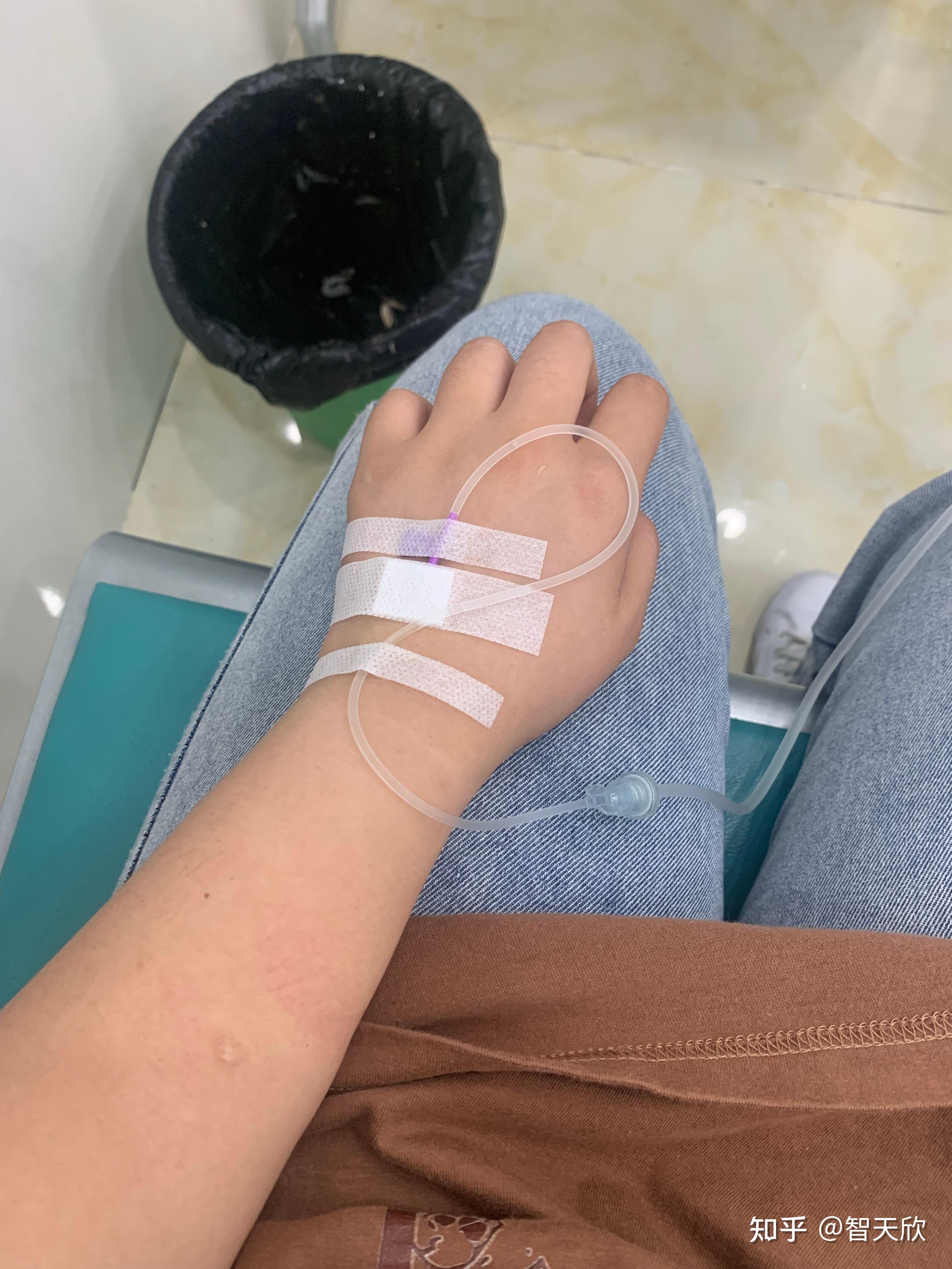 有没有输液的照片我给老师请的病假她要我发照片给她