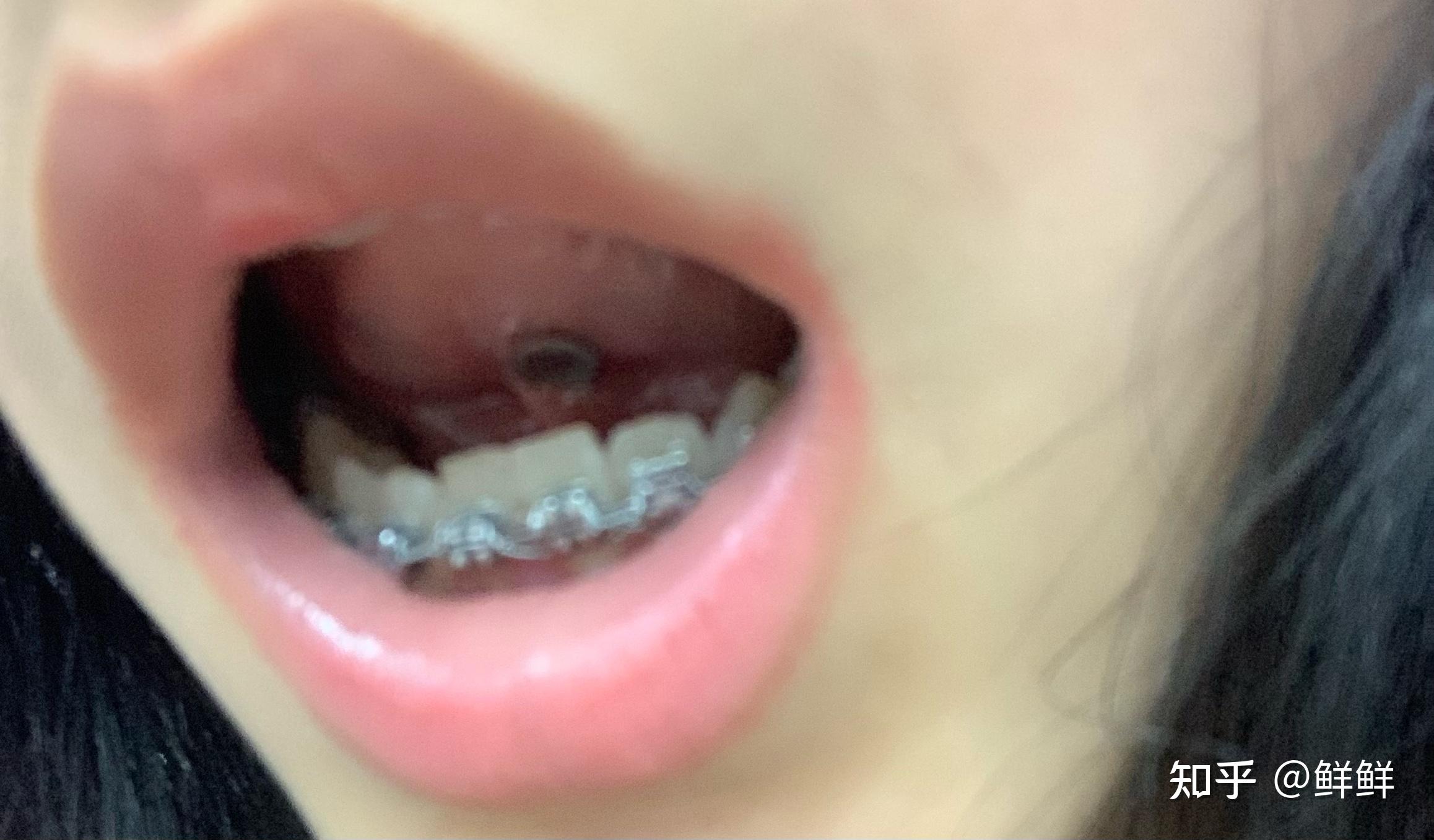 伟德国际女护士_标签_网易出品