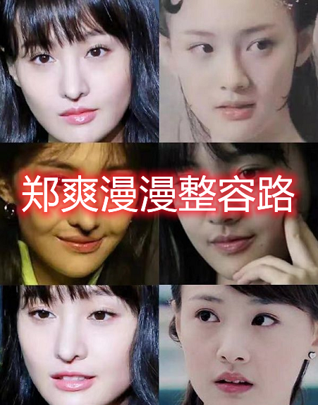 郑爽事件持续升级回顾郑爽十年整容路