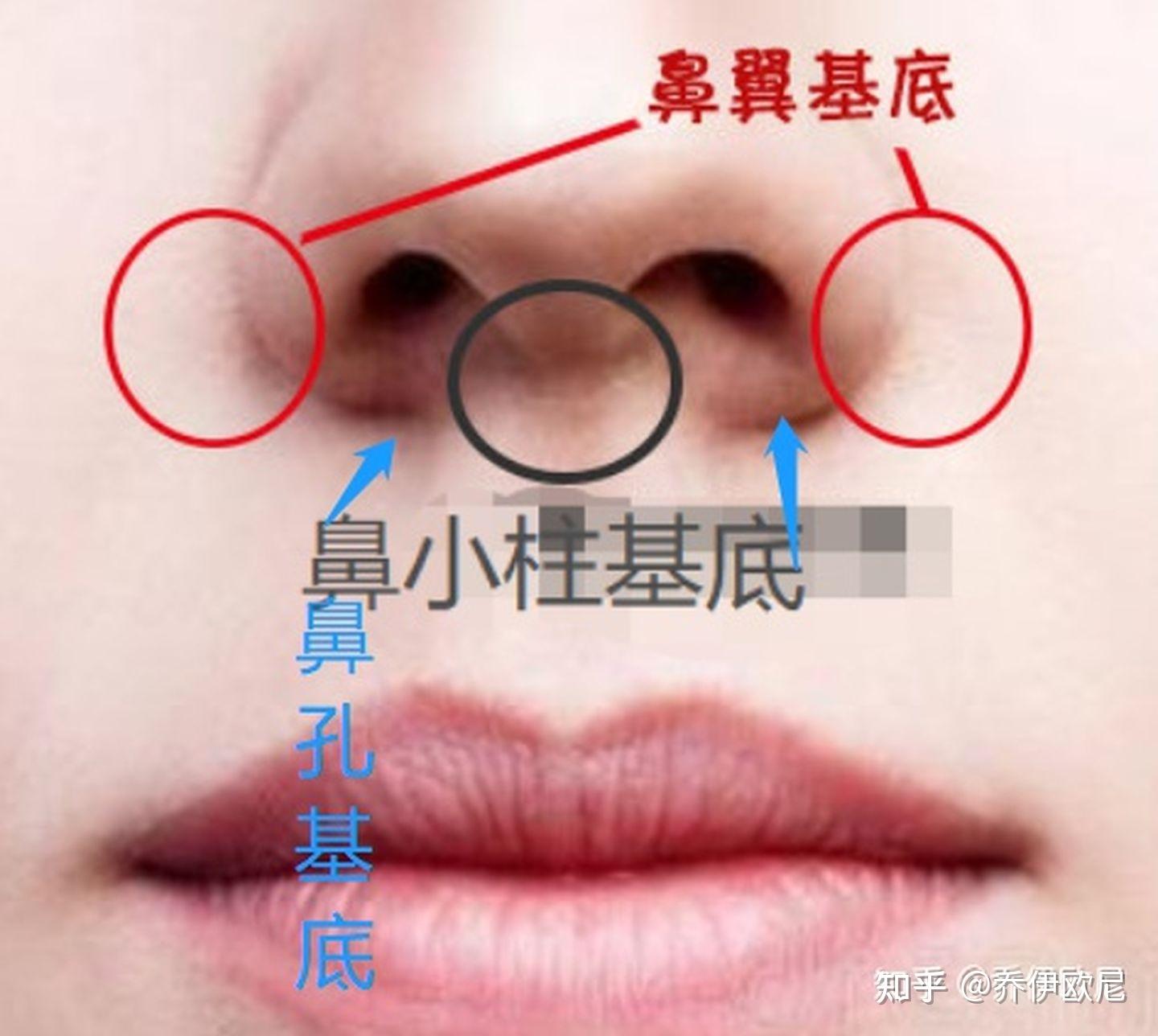 鼻基底凹陷和面部凹陷区别是什么? - 知乎