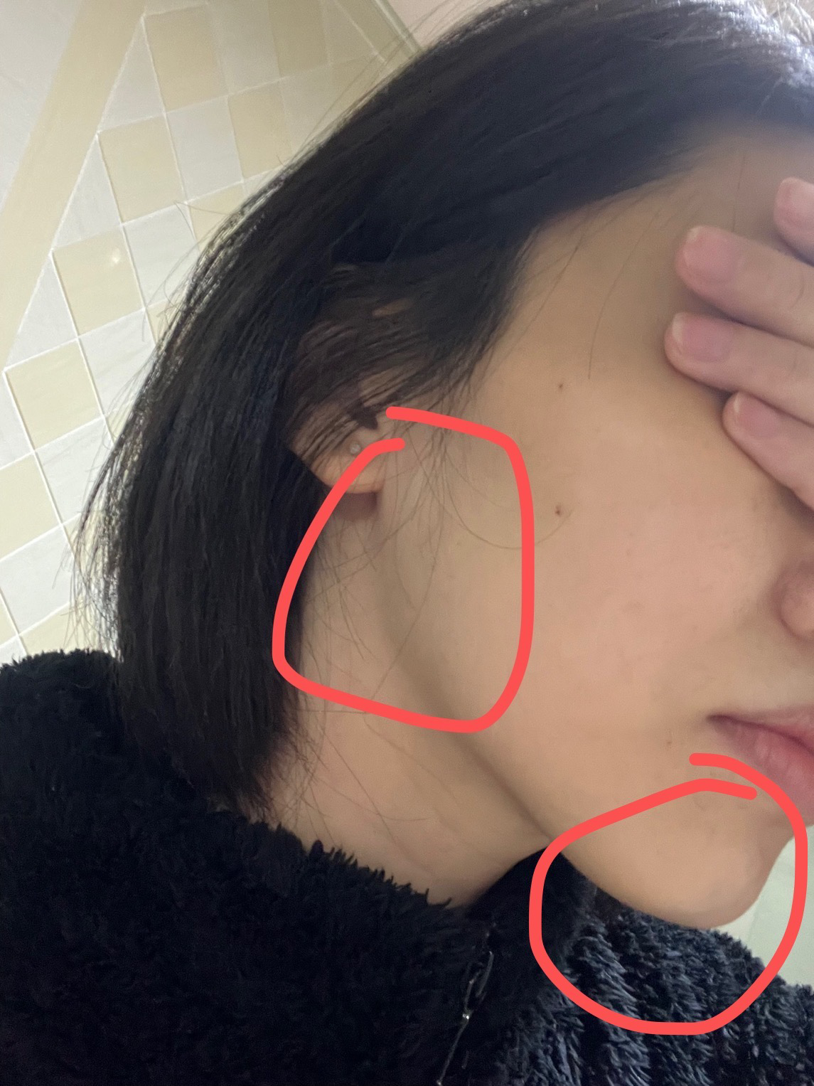 严重偏颌,两位医生给了两套方案,不知道该做怎样的选择? - 知乎