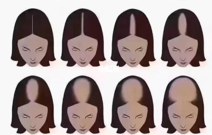 黑米3D纹发：纹发都是男性寸头造型，女性可以纹发吗？ - 知乎