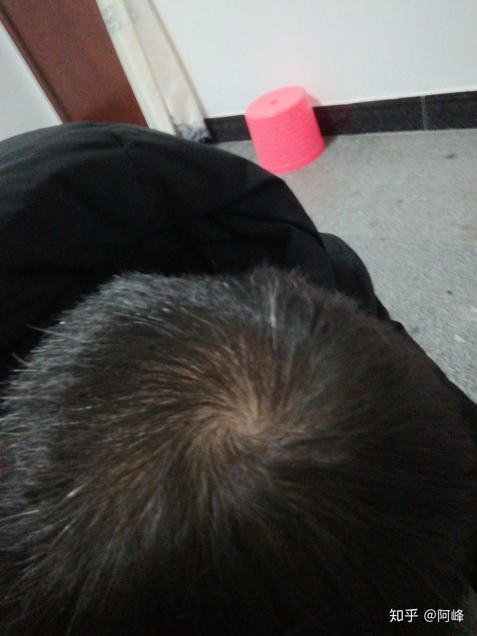 头上的发旋附近头发很少.怎么办? - 知乎