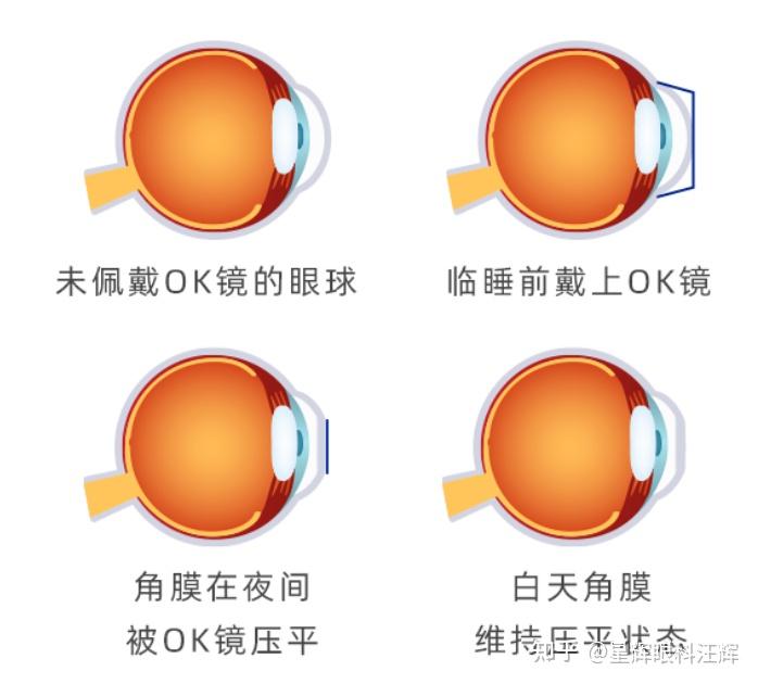 OK镜原理是什么？ - 知乎