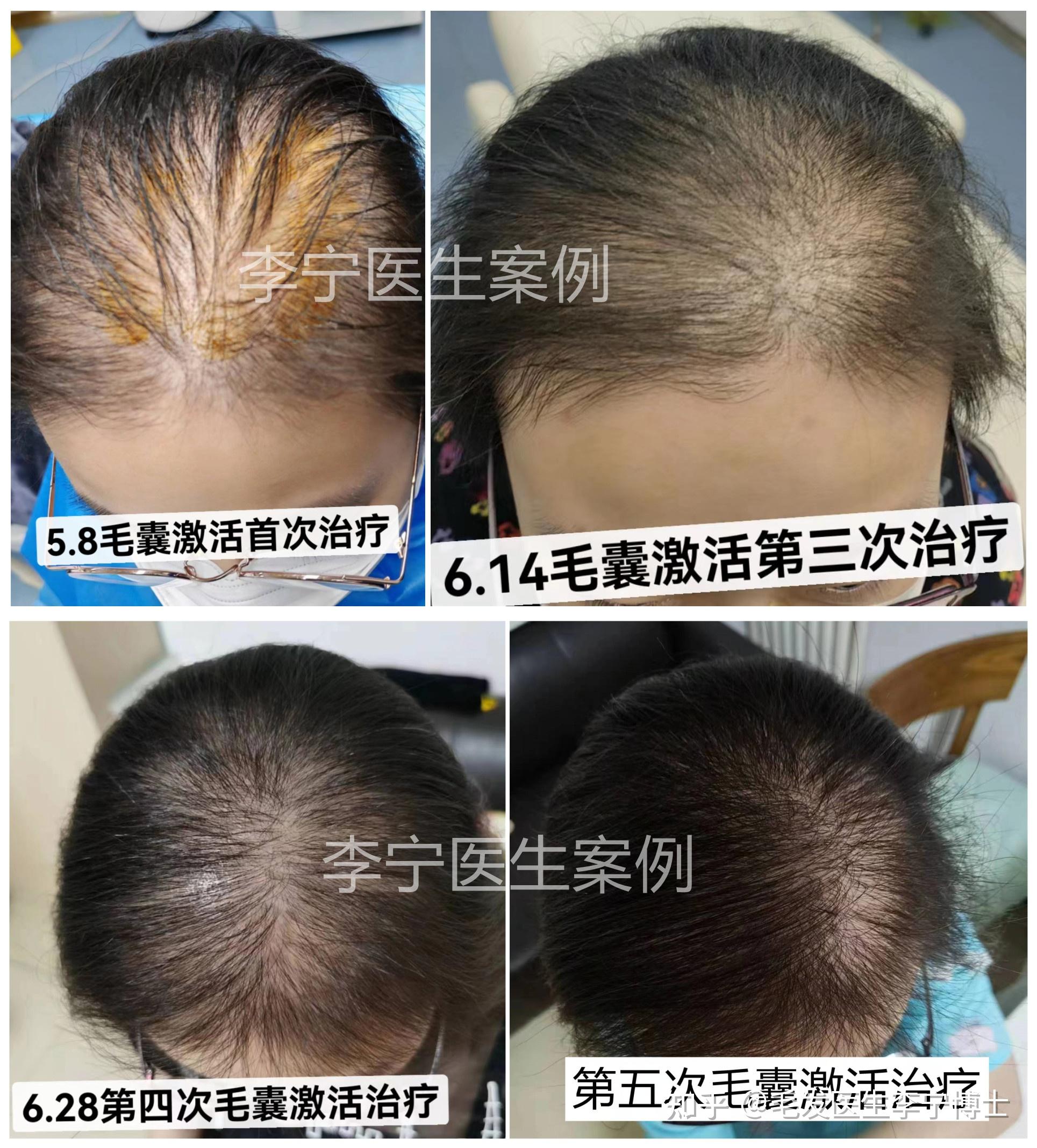 发缝明显 有什么办法吗? - 知乎
