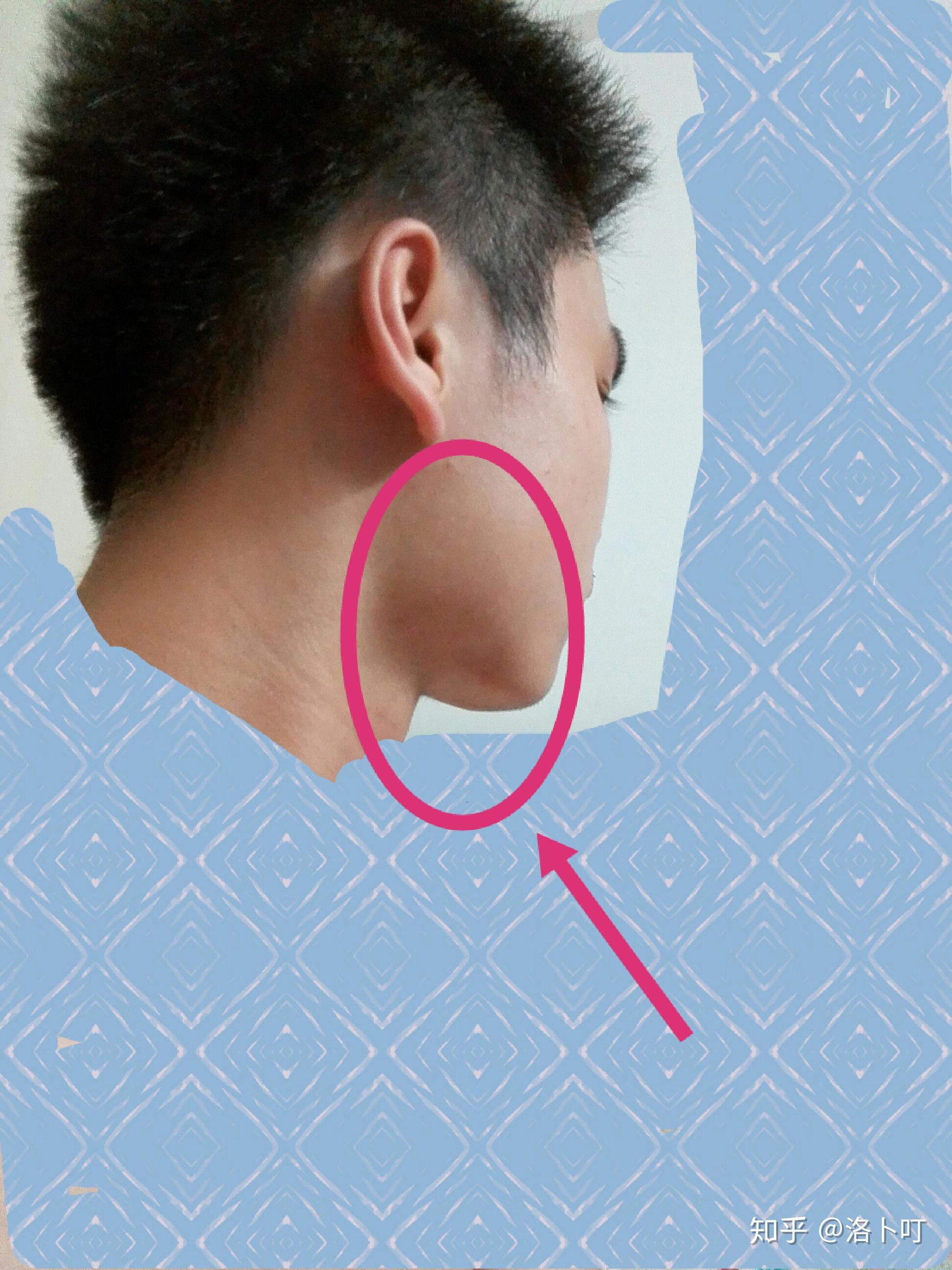 有什么适合下颚角大导致脸型"方正"的男生发型以及穿衣打扮? - 知乎