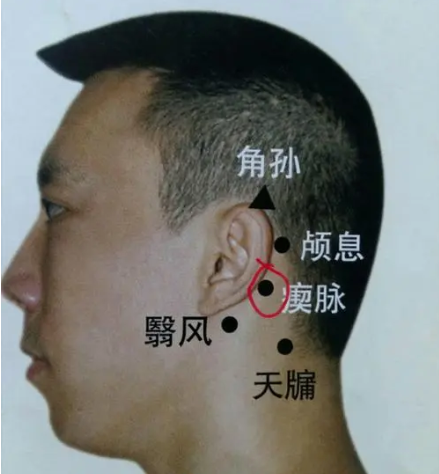 你的孩子患有抽动症吗试试艾灸瘛脉穴