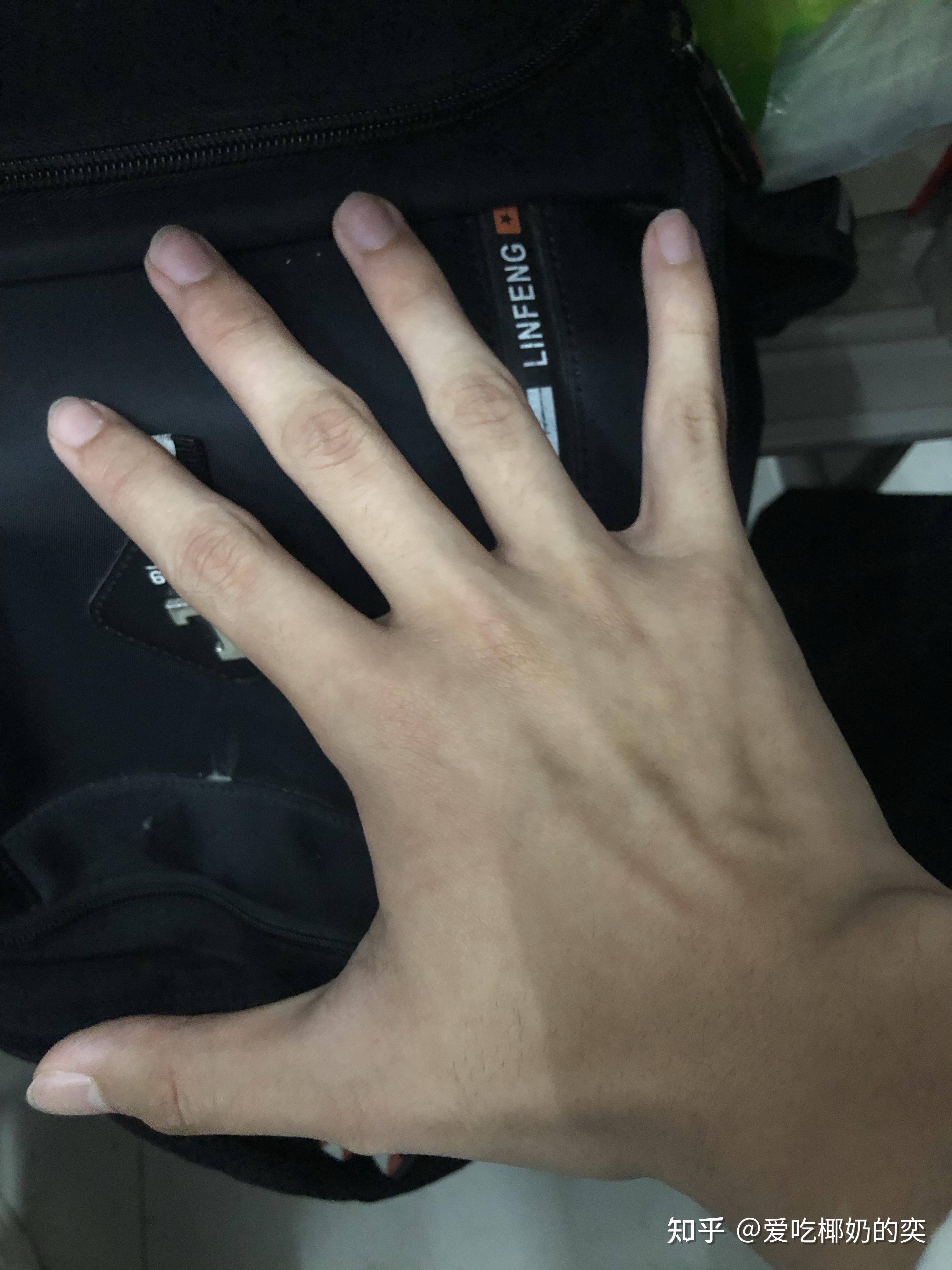 手指关节粗大而怎么恢复? - 知乎