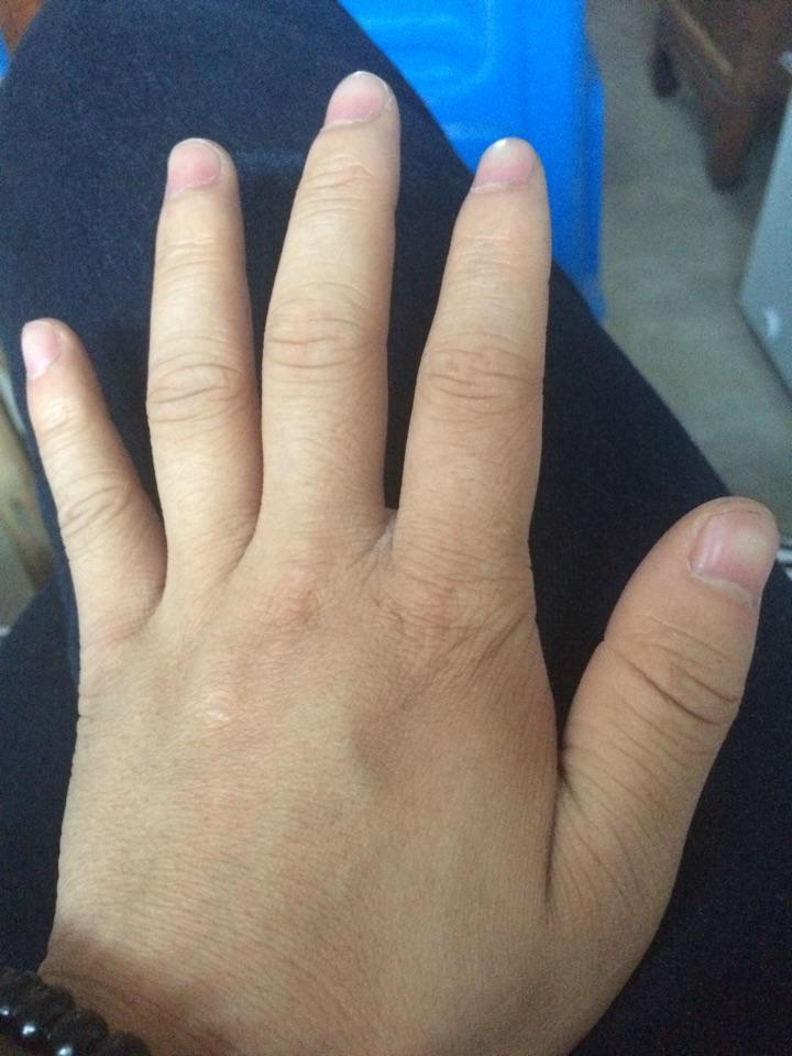 手指短而圆是一种怎样的体验