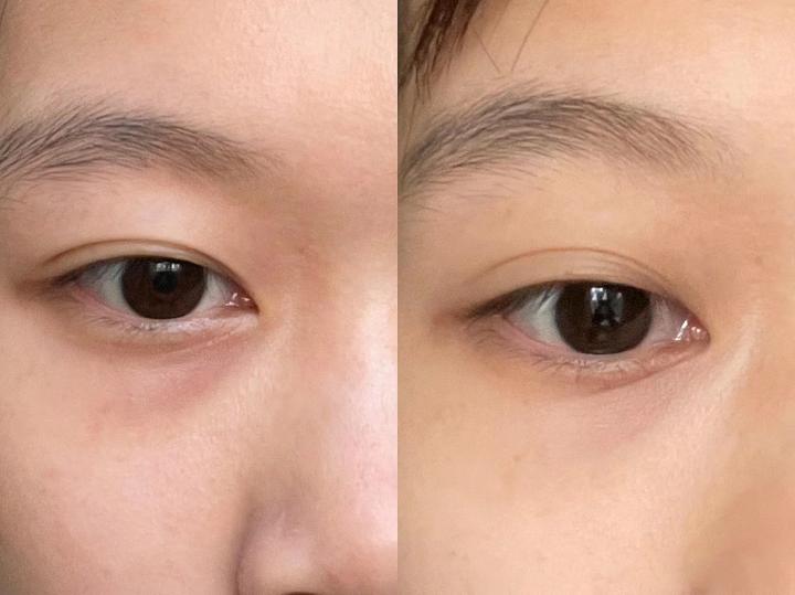 眼霜推荐去细纹抗皱第一名!眼周抗皱必选眼霜推荐,衰老问题简化公式 - 知乎