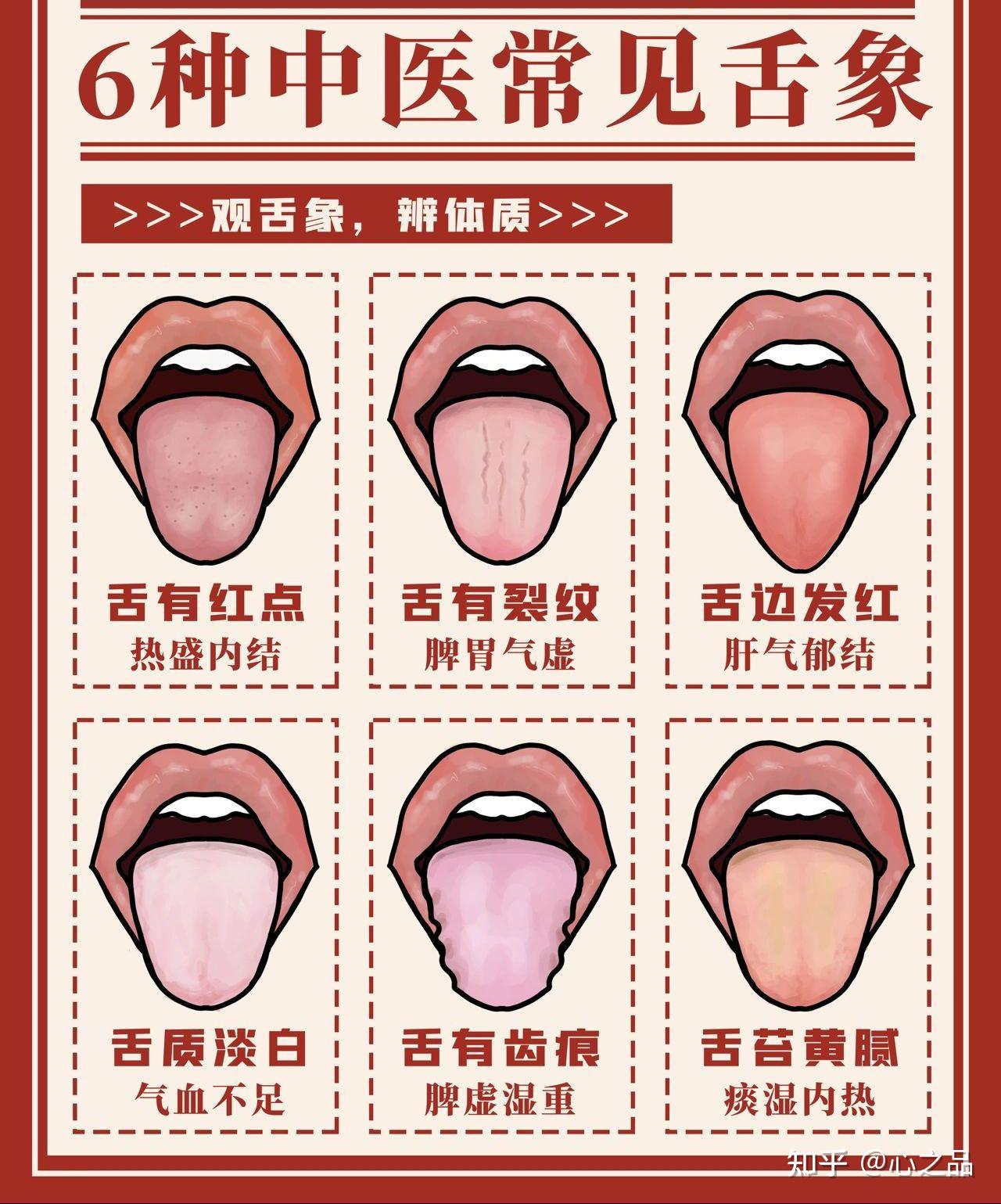 怎么通过舌诊判断自己的身体状况? - 知乎