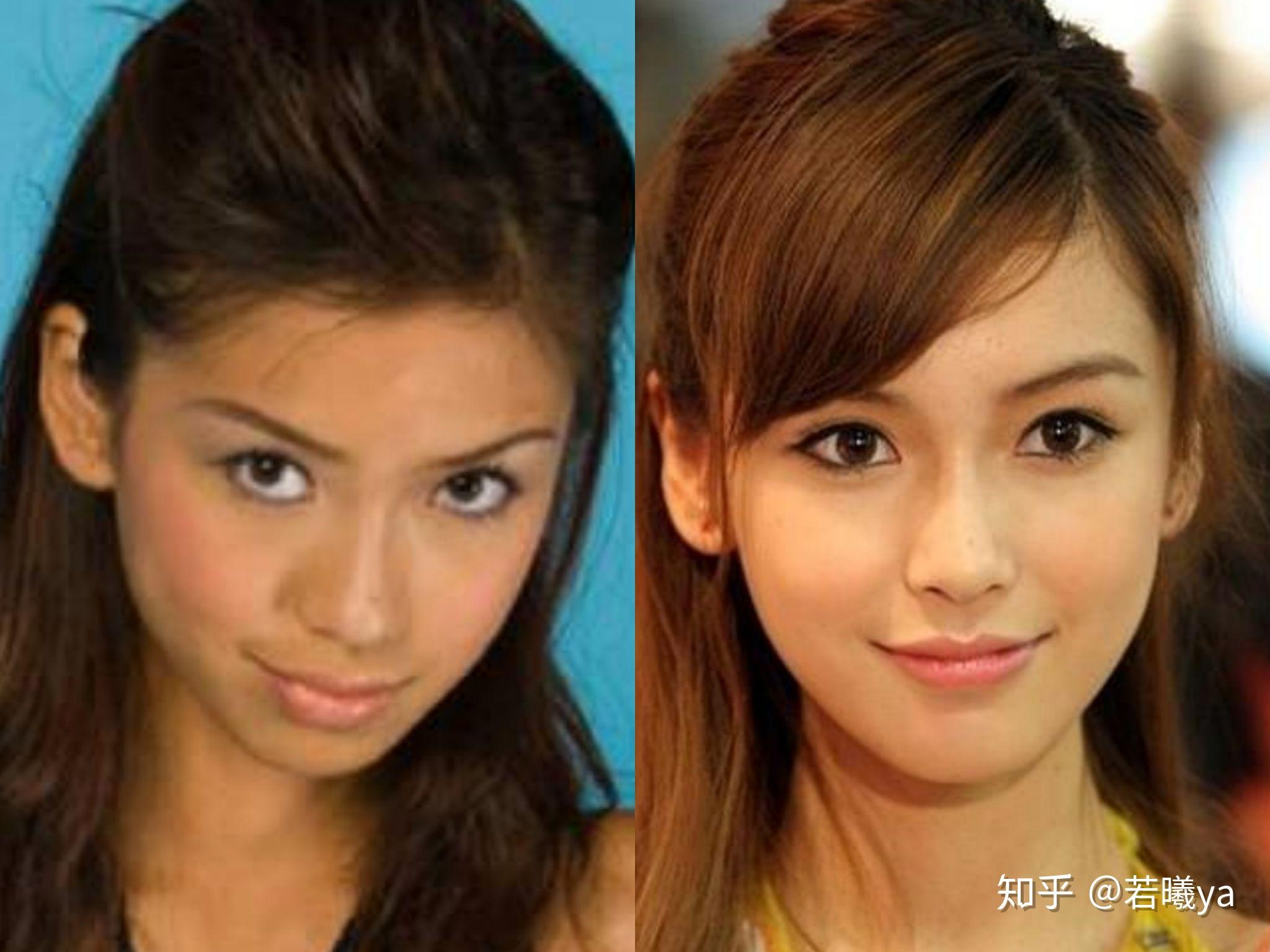 angelababy整容哪些部位? - 知乎