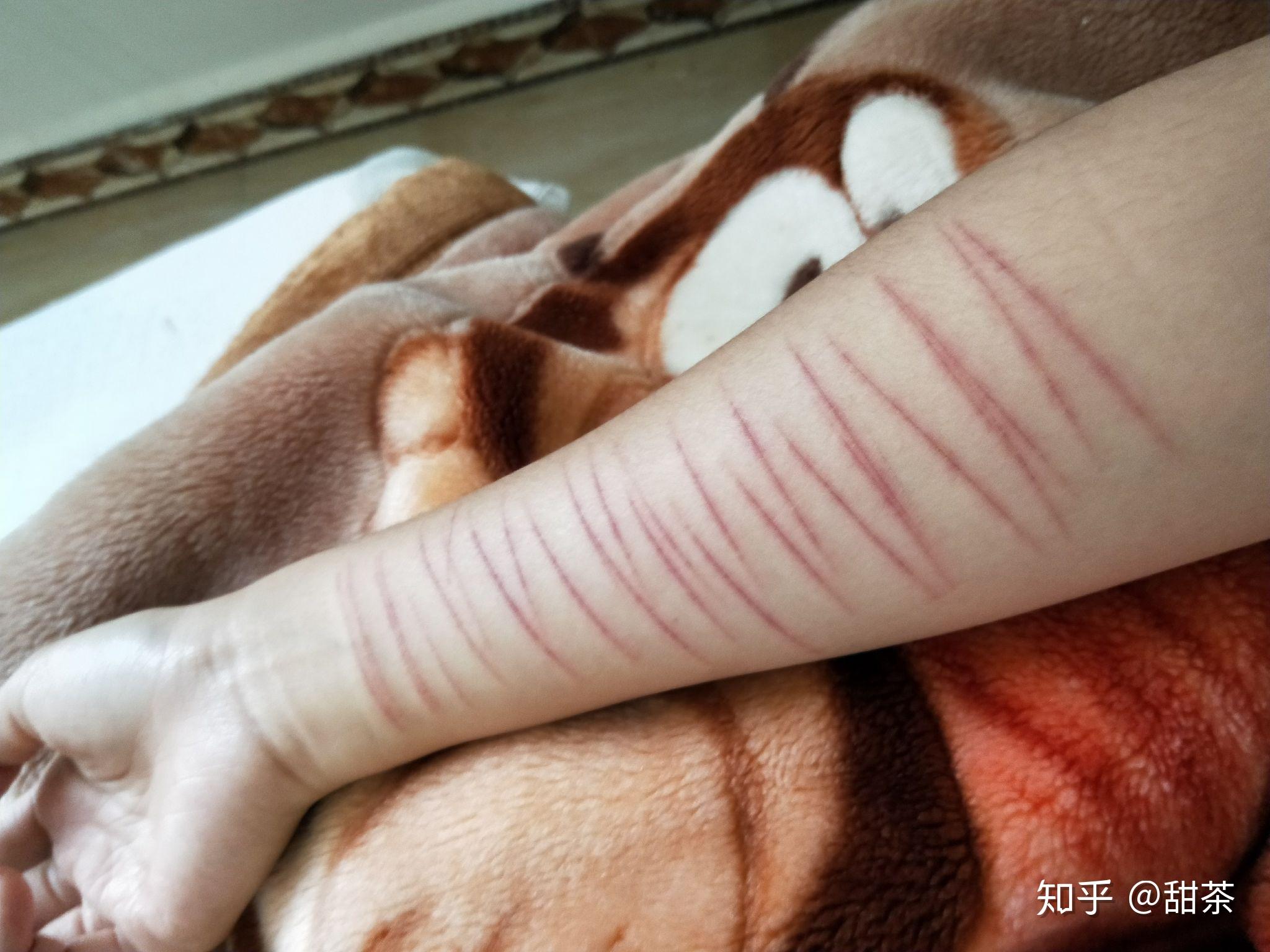 自残属于什么心理
