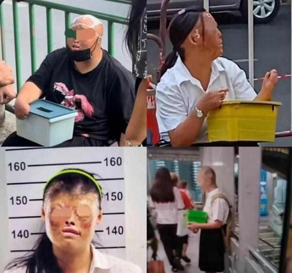 缅北激战之后一批中国乞丐出现在泰国街头毁容剁手月入40万