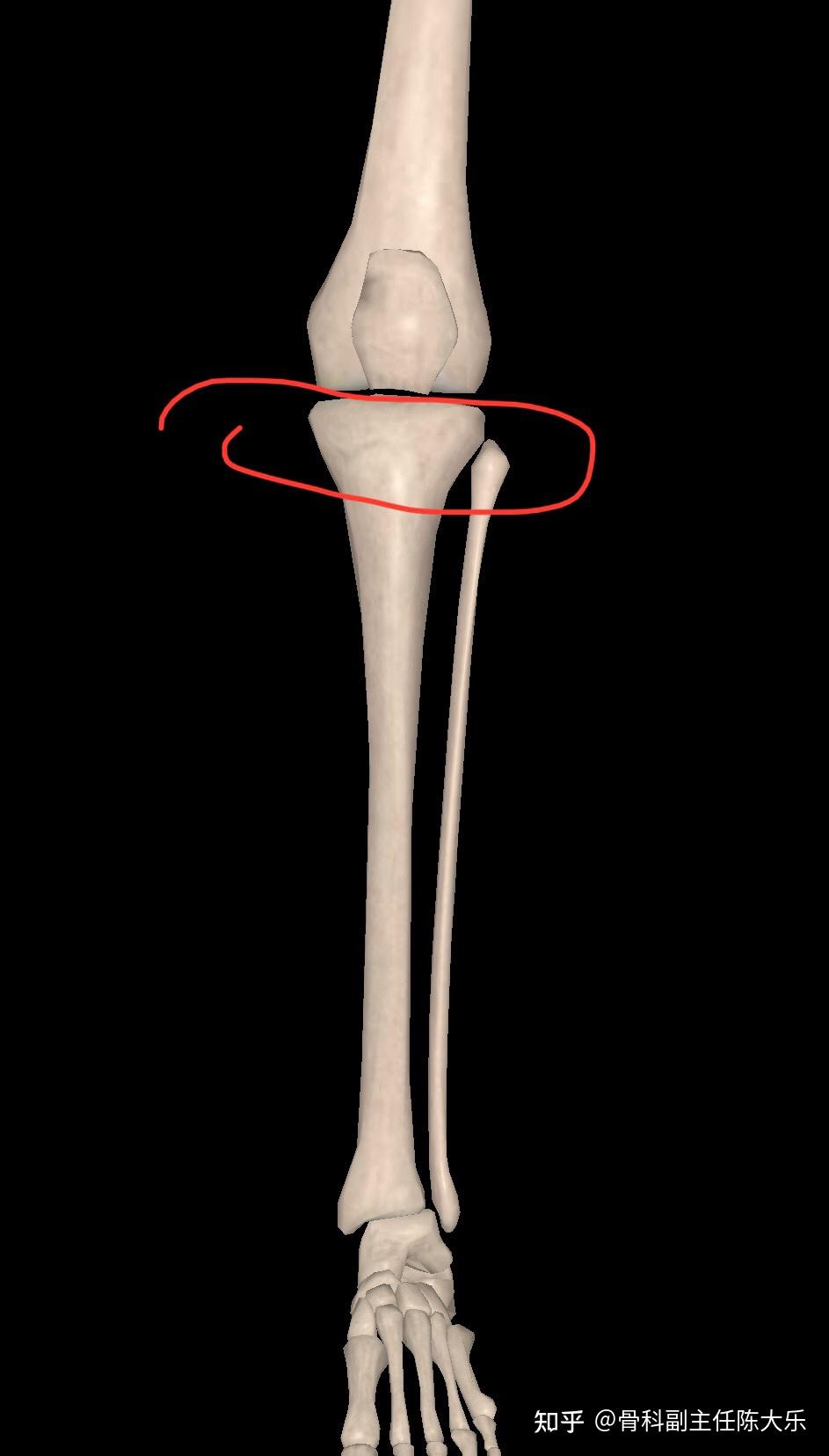 胫骨平台解剖图位置图片
