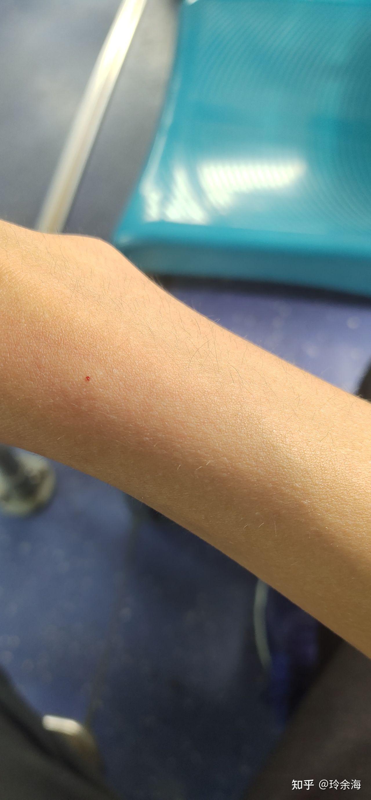 被七星瓢虫咬了会怎么样? - 知乎