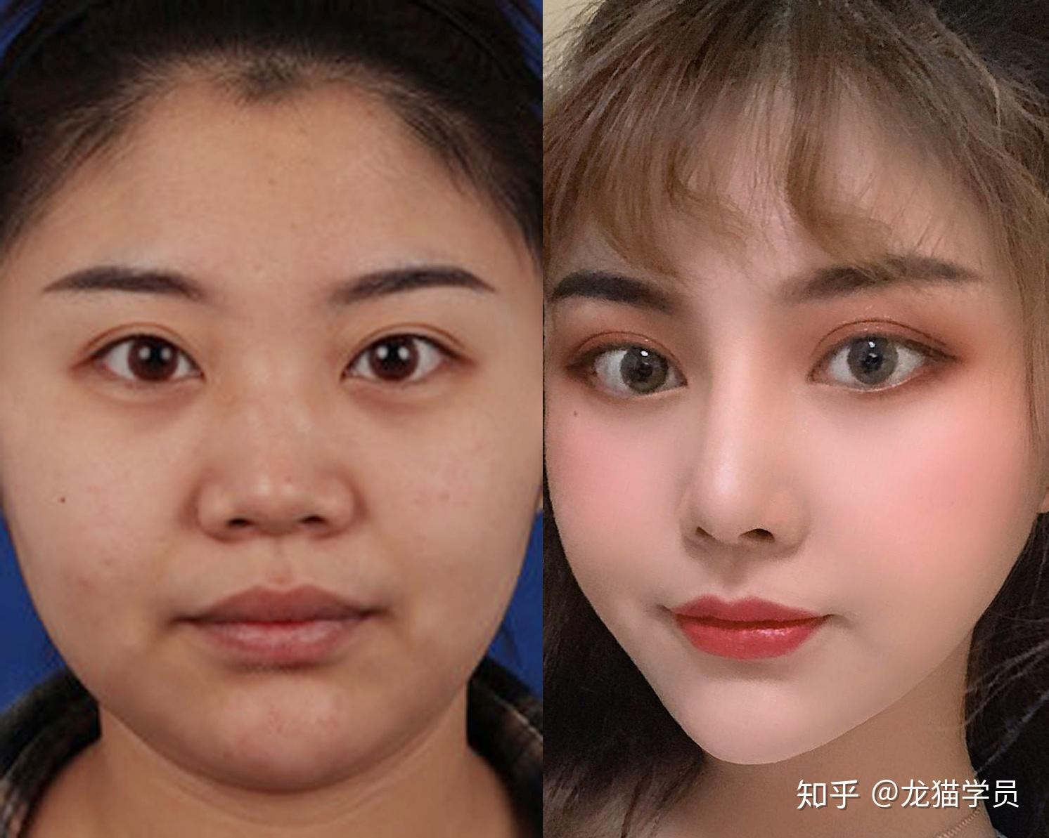 为什么明星整容就算是换头式整容也能整得这么自然而普通人整的基本都