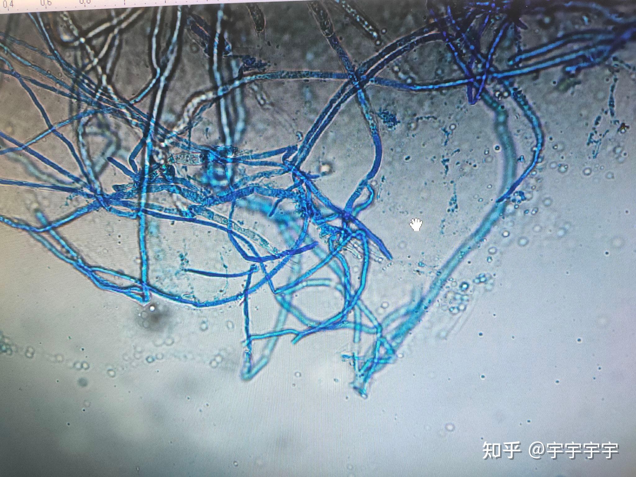禾谷镰刀菌如何产孢