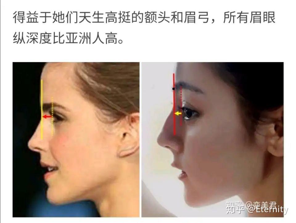 鼻子高但是山根低是什么样? - 知乎