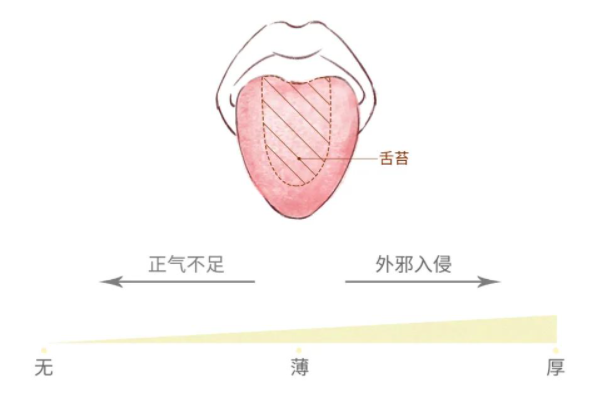 一看就懂|简单实用的舌诊图谱大全，教你快速识别疾病！ - 知乎