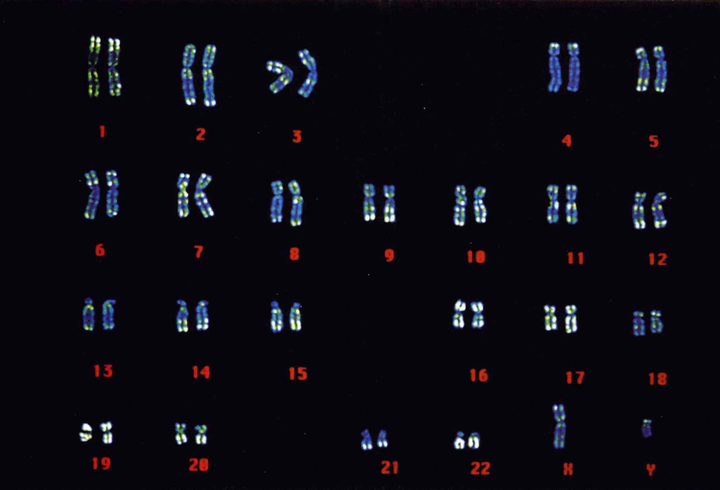 染色体结构重排——易位 - 知乎