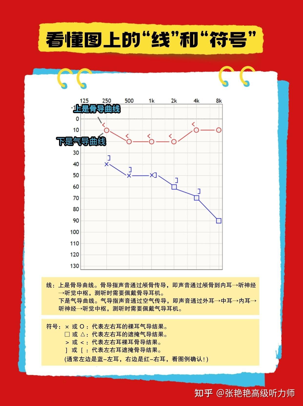 如何看懂听力图？保姆级教程 - 知乎