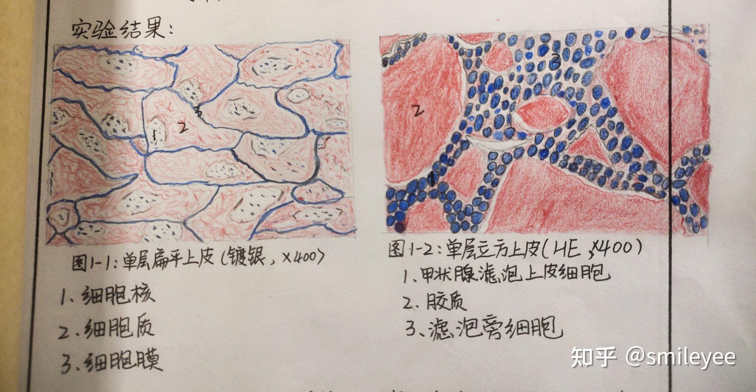 单层扁平上皮简图图片