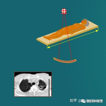 CT基础知识——扫描方式 - 知乎
