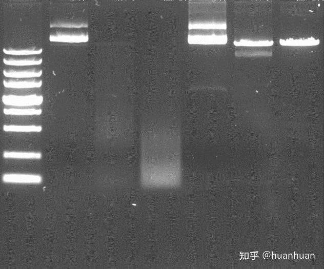 质粒跑胶图片