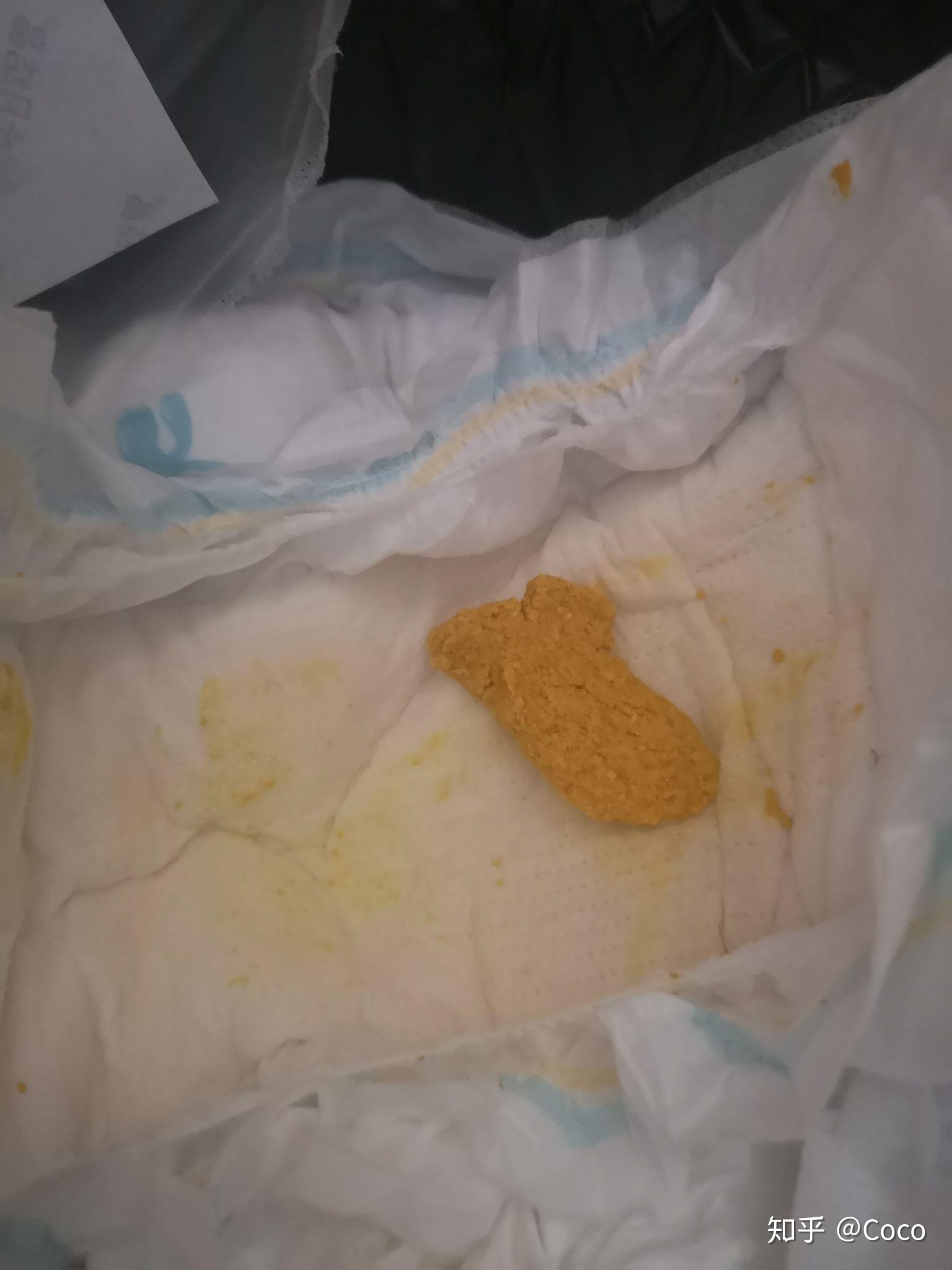 月子里的宝宝大便干燥是什么原因?母乳喂养? - 知乎