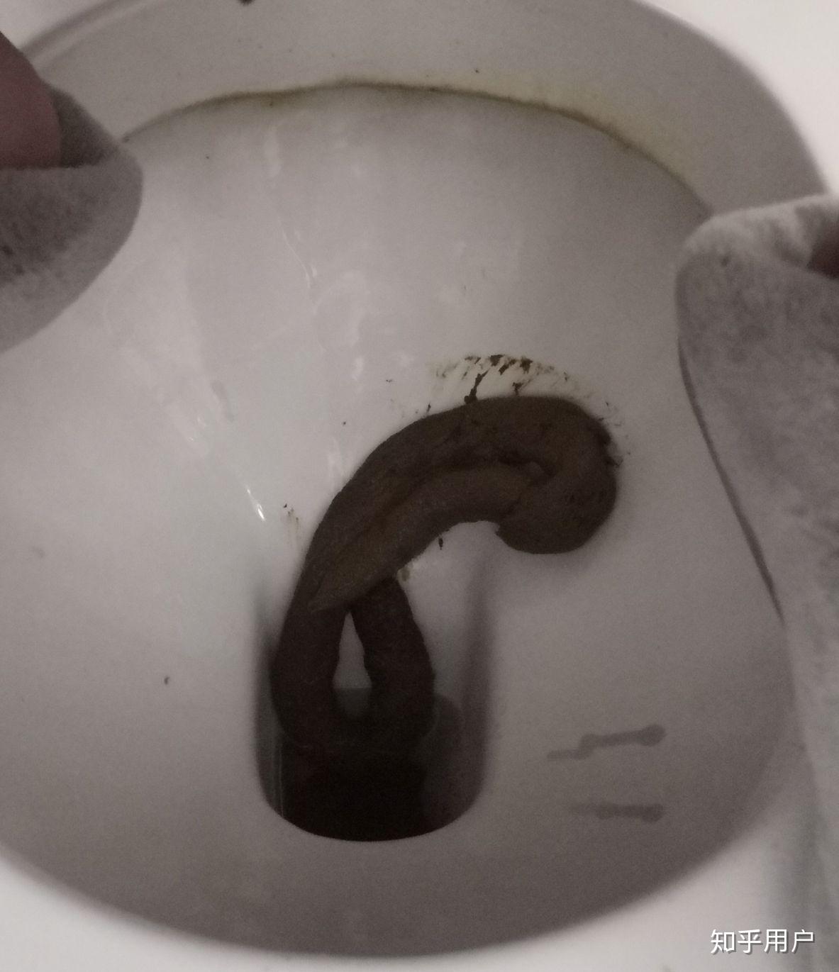 你拉过最长的屎有多长? - 知乎