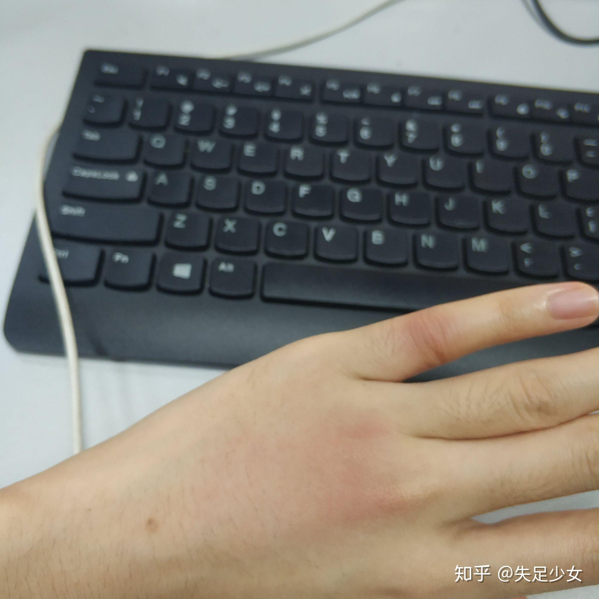 被蚂蚁咬了伤口周围有硬物感中间还有个小泡今天是第三天了还没好怎么