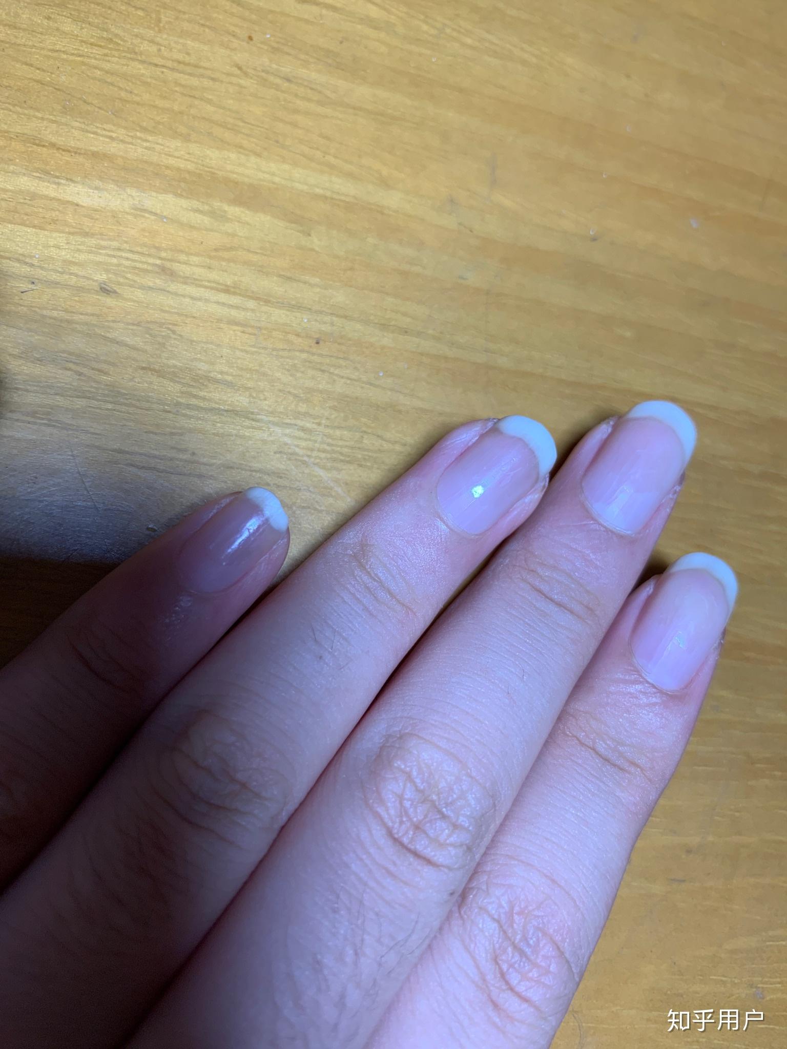 为什么我手指甲前端是白色的,看着好怪啊,是有什么问题吗?