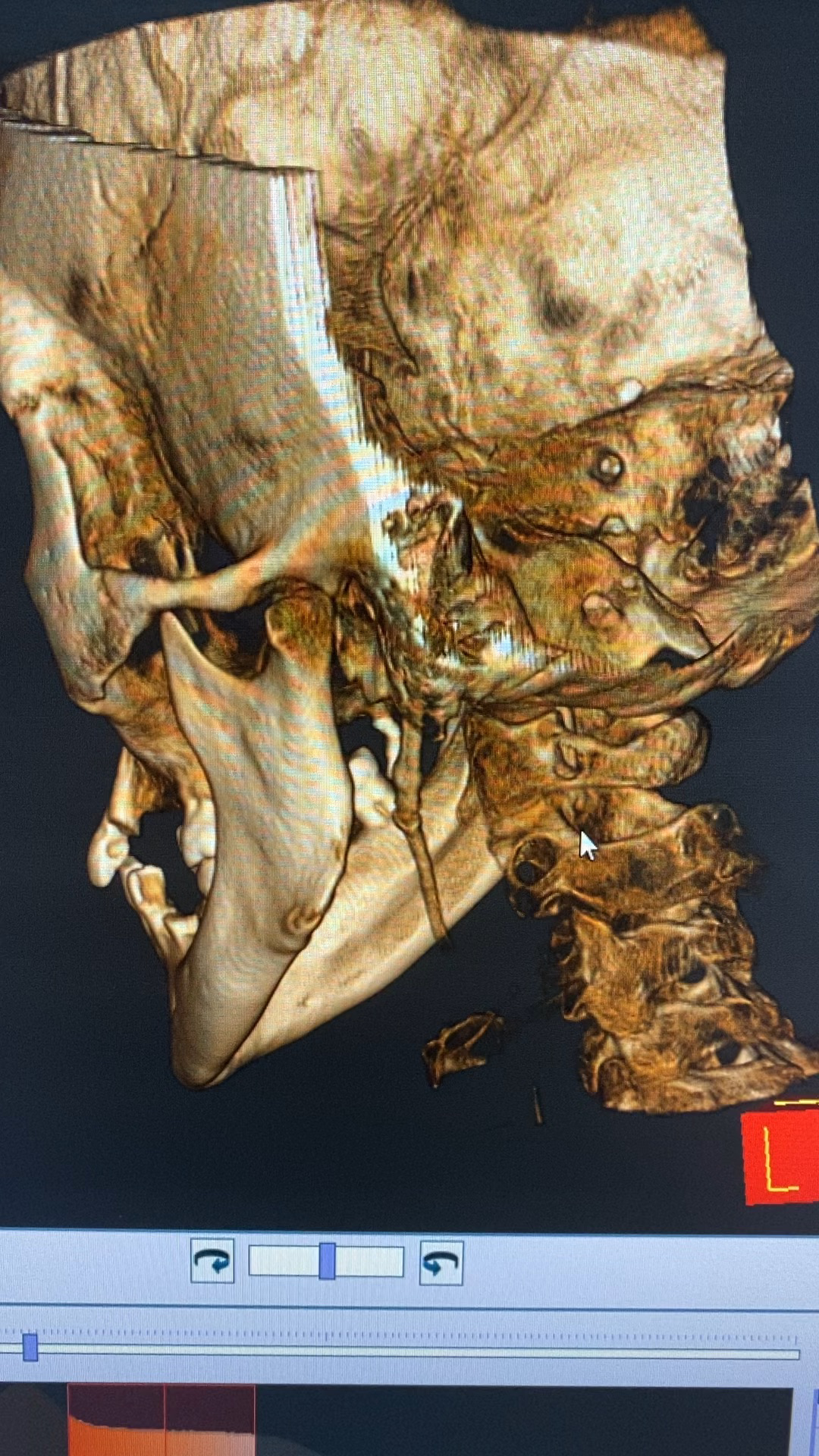 茎突过长的影像 - 知乎