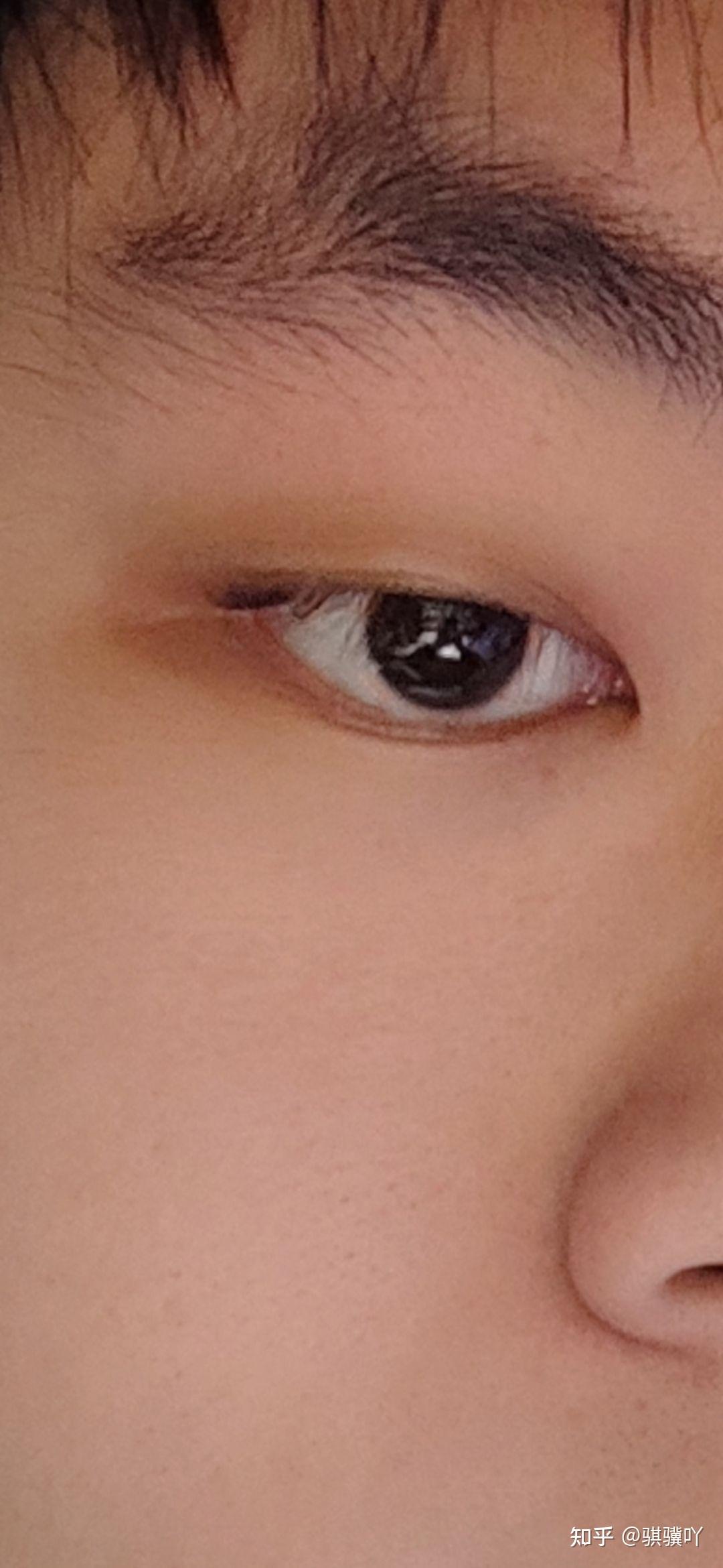 有眼尾沟的眼睛好看吗?