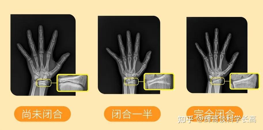 为什么每次带小孩去做儿童保健都感觉是在交智商税