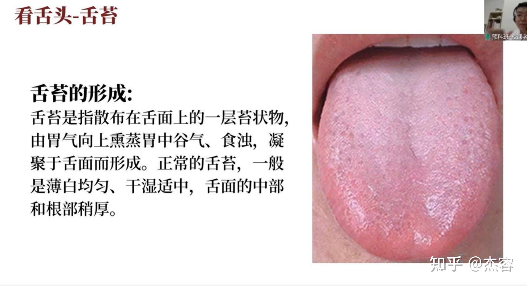 中医学习笔记5:舌诊 - 知乎
