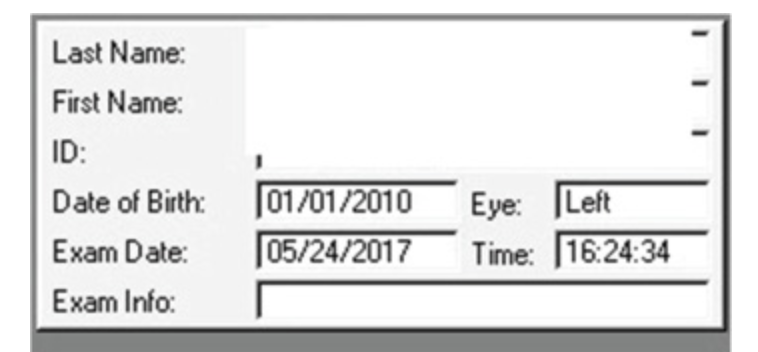 为什么超声角膜测厚检查怎么看角膜地形图呢？？_https://www.jmylbn.com_新闻资讯_第5张