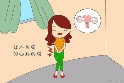 附件炎都有什么特点?女性须知 - 知乎