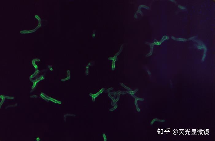 显微镜下的双歧杆菌 - 知乎